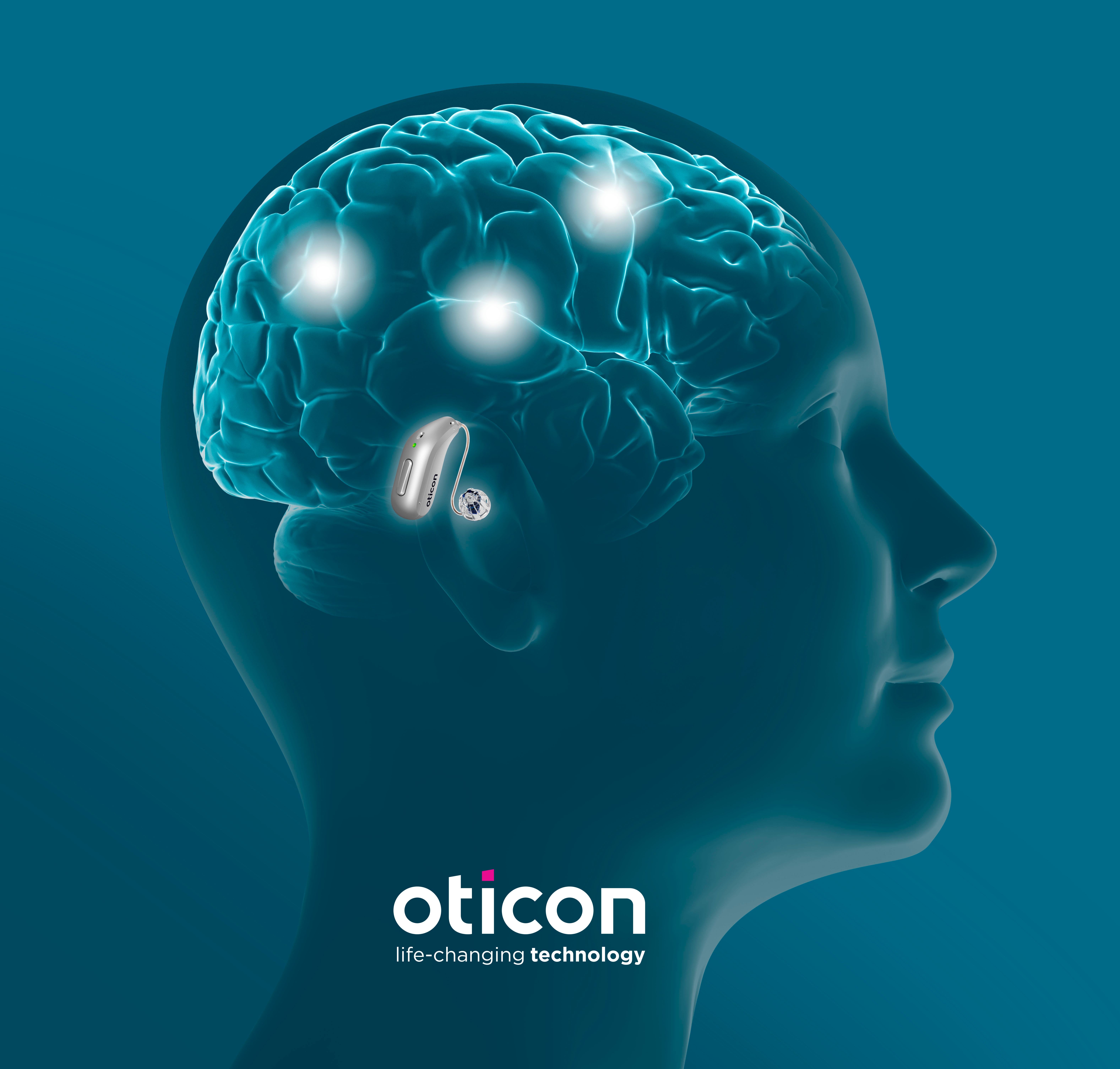 Oticon BrainHearing technology
